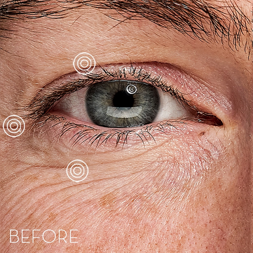 Skin Office Paris - Eye Recipe