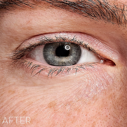 Skin Office Paris - Eye Recipe