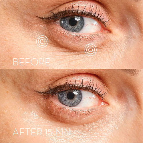 Skin Office Paris - Eye Precision Mask