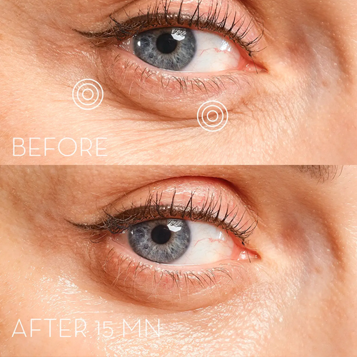 Skin Office Paris - Eye Precision Mask